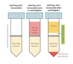 ROTI®Sep 1077 Human/tube 7 ROTI®Sep 1077 Human/tube -Laborbedarf Geschäft 0634 Anwendung 1000Wx1000H