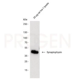 Anti-Synaptophysin Mouse Monoclonal, SY38, 0.2 Ml -Laborbedarf Geschäft 1000Wx1000H 1NN3 04